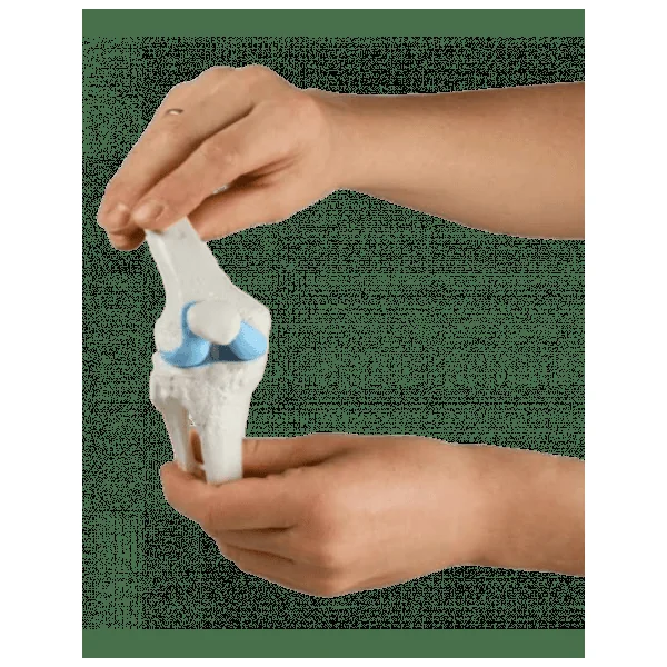 3 Modèles de genou - Sain, malade et avec implant Erler Zimmer 1125