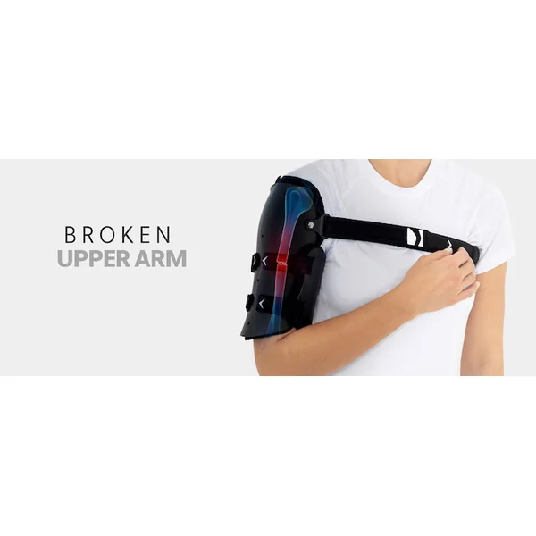 Attelle bivalve indiquée pour les fractures de l'humérus avec support de bras