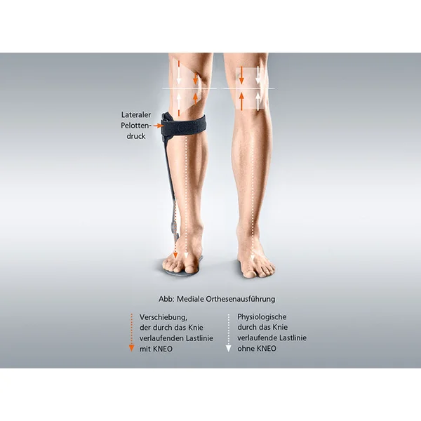 Attelle de cheville pour le traitement de la gonarthrose par décharge compartimentale Kneo