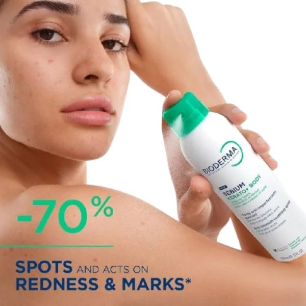 BIODERMA - SEBIUM - SPRAY ANTI IMPERFECTIONS APAISANT - 150 ML