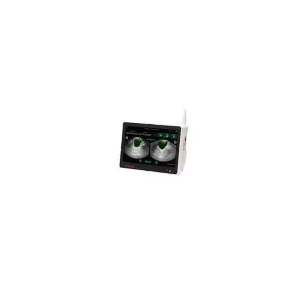 Bladder Scanner Vitascan Evue