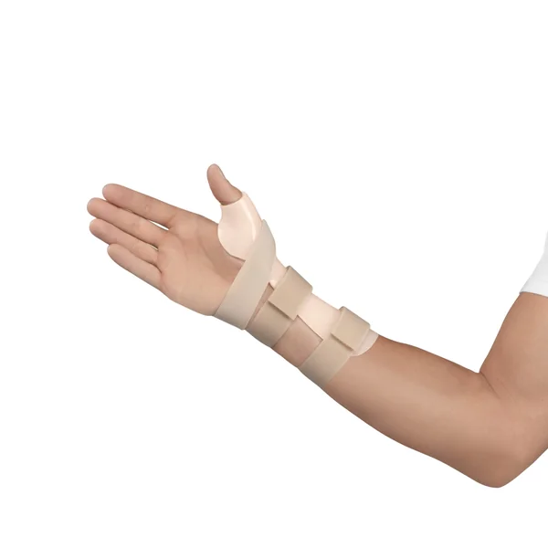 Orthèse d'immobilisation poignet-pouce thermo-formée