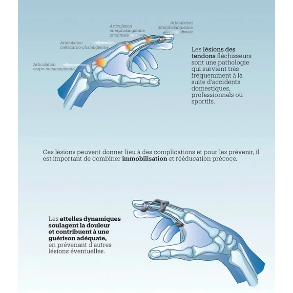 Orthèse dynamique de mise en extension du doigt type Capener FingerExt