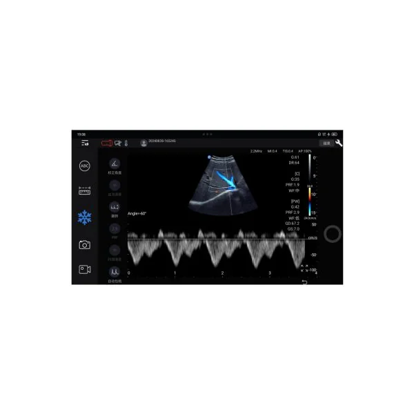 Sonde d'échographie portable EDAN Nano pour smartphone et tablette