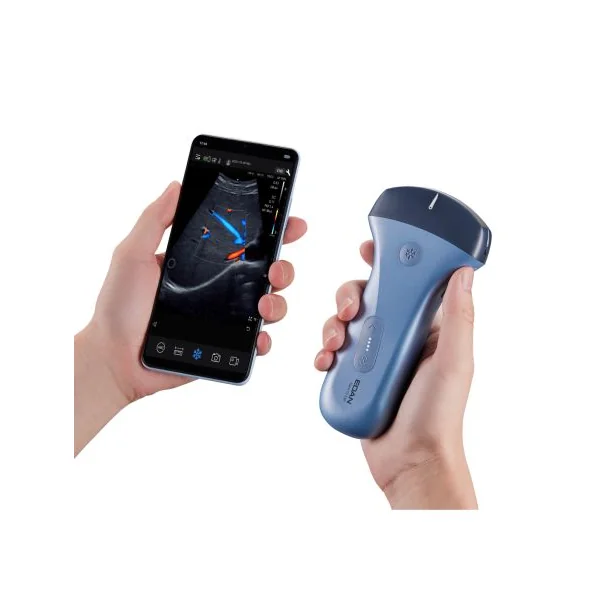 Sonde d'échographie portable EDAN Nano pour smartphone et tablette