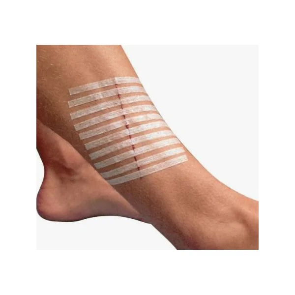 Suture 3M STERI-STRIP